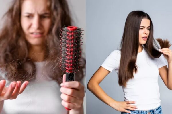 Natural hair care | Scalp health tips | Anti-hair fall diet | Ayurvedic remedy for hair fall | Today Latest Update in Hindi | NewsTrack Hindi News | UP Ka Taaza Samachar in Hindi | Monsoon Hair Fall Food: बारिश के मौसम में क्यों झड़ते हैं बाल? इन असरदार फूड्स से करें हेयर फॉल कम