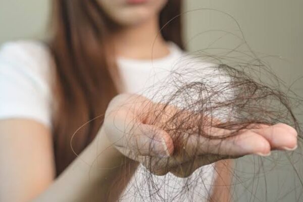 Hair loss solution | Hair fall due to stress | Nutrient deficiency hair fall | Hair care tips | Prevent hair fall | Healthy diet for hair | Newstrack lifestyle news | रोजाना कितने बाल टूटना नॉर्मल है? कब आपको हेयरफॉल को लेकर चिंता करनी चाहिए, जानें एक्सपर्ट की राय