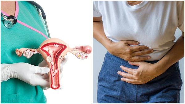 Increased Risk of Uterine Cancer in Women Due to Weight Gain, Do these things to avoid